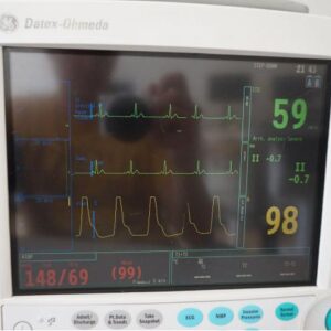 GE Datex Ohmeada S/5 FM patient monitor